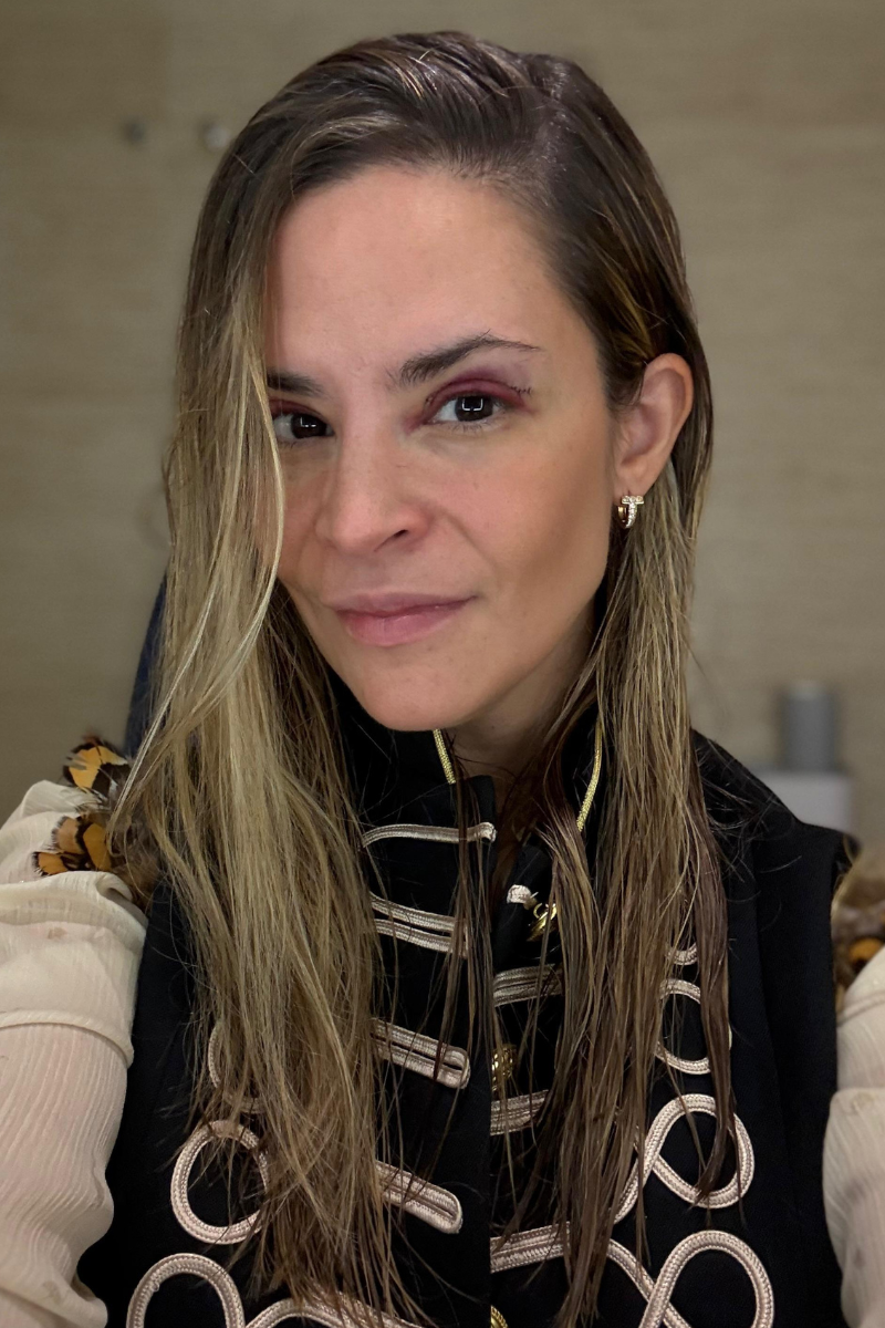 Blefaroplastia superior día 2 postoperatorio con inflamación leve y evolución de sutura en párpado superior