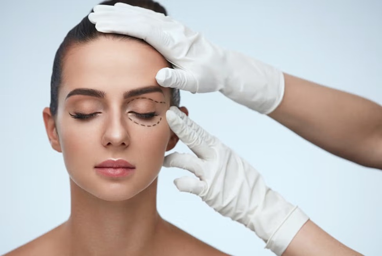 Mujer con marcación estética en el contorno de ojos, evaluación médica para tratamiento de ojeras, bolsas y elevación de la ceja en medicina estética
