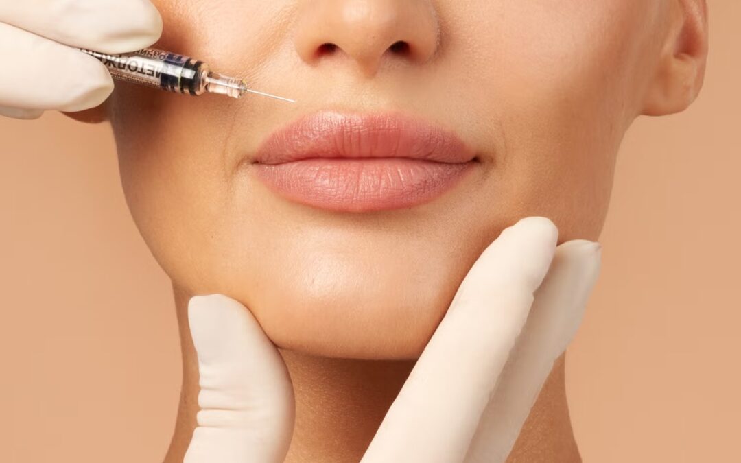Tratamiento para arrugas del labio superior y código de barras recomendado por la Dra. Victoria Trasmonte