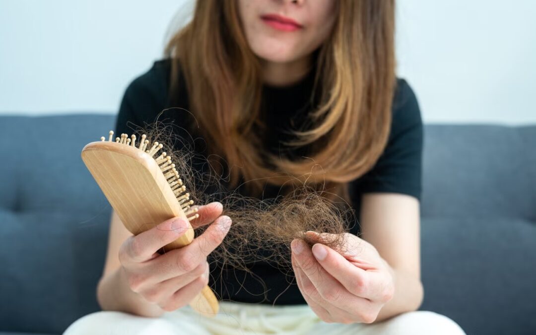 Mujer con caída de cabello por alopecia femenina al cepillarse el pelo, ejemplo de pérdida capilar asociada a distintos factores.