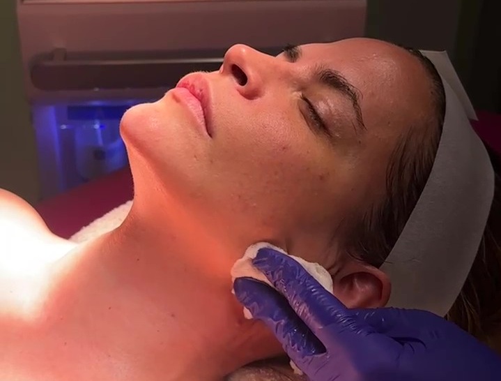 Limpieza facial profesional personalizada con cosmética especializada para mejorar la salud y luminosidad de la piel.