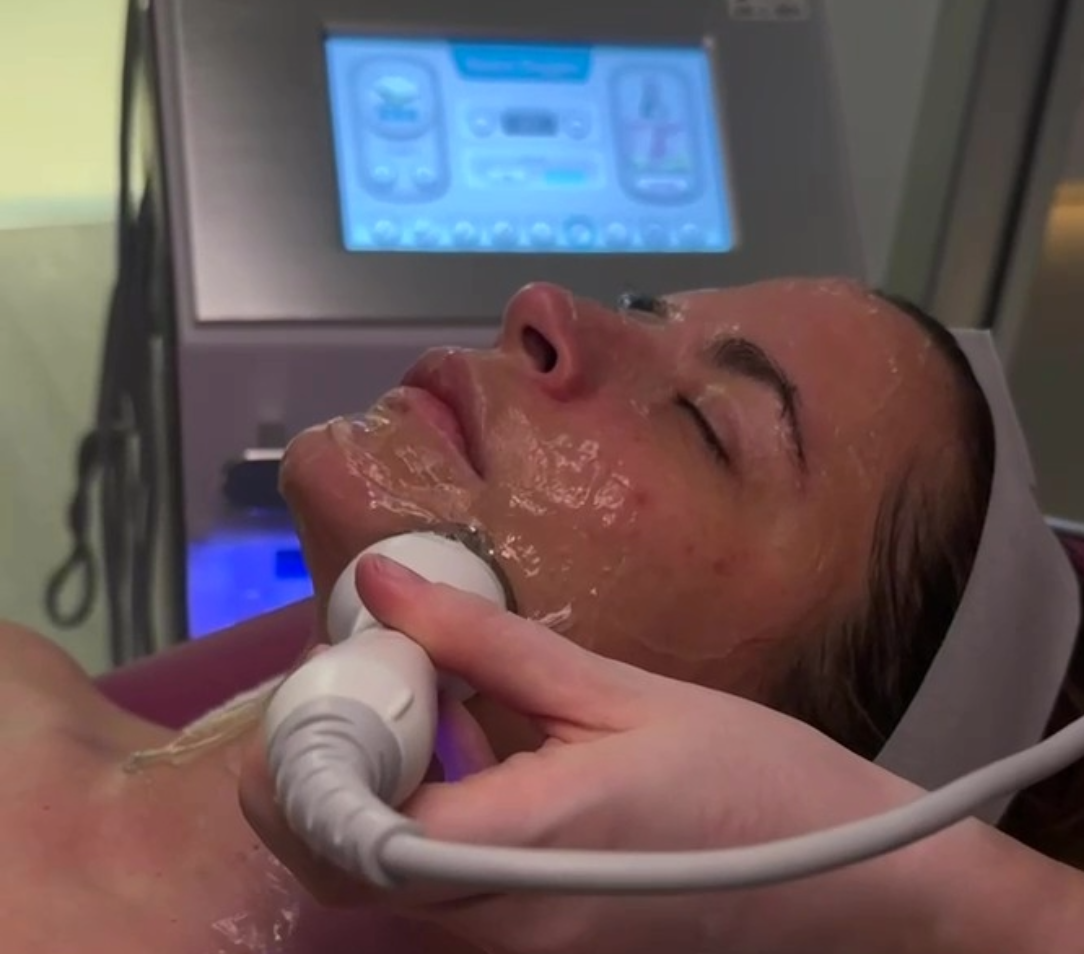 Tecnología facial durante una limpieza facial profesional para potenciar la hidratación, la luminosidad y la salud de la piel.